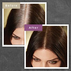 ΚΑΛΥΨΗ ΛΕΥΚΩΝ ΚΑΤΗΓΟΡΙΑ